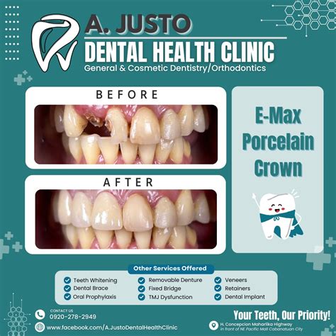justo dental clinic|Justo Dental Clinic .